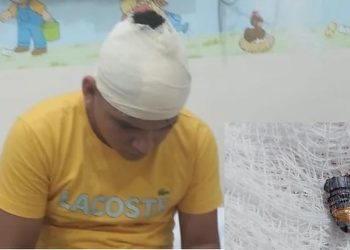 Vítima de bala perdida no Amazonas fica com projétil preso no couro cabeludo
