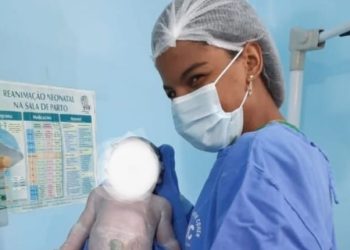 Após se passar por pediatra em Parintins, jovem é presa fingindo ser ginecologista em Recife