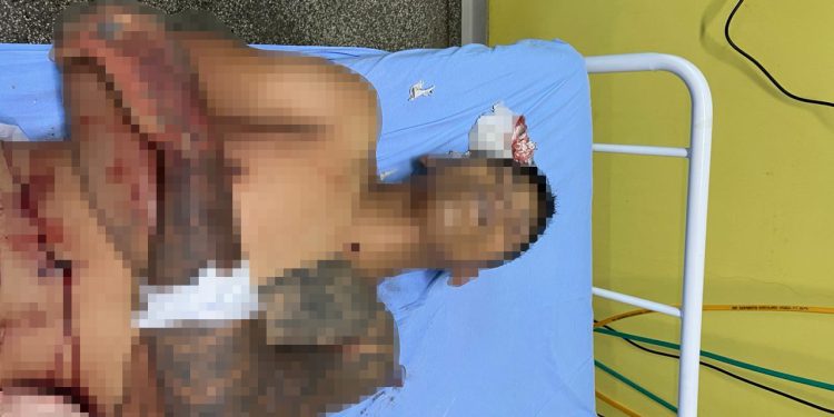 Bandido envolvido em execução de PM morre em confronto com a polícia