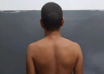 Menina de 8 anos é estuprada por padrasto e contaminada com HIV