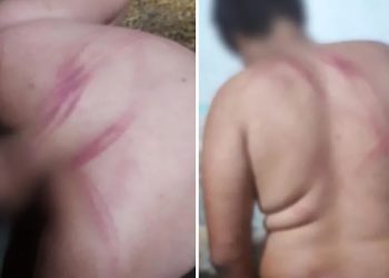 Família acusa PM de agredir adolescente com deficiência, que acusa menino de puxar arma do oficial