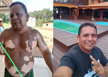 Vítima de explosão de embarcação morre no 28 de Agosto