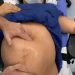 Médico viraliza ao ‘encaixar bebê sentado’ minutos antes do parto