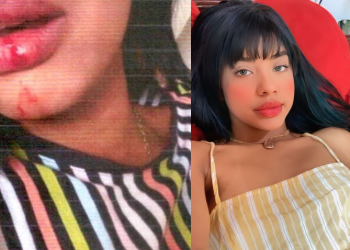 Laudo do IML confirma agressões na boca, tórax e coxa da cantora Bruninha, que denunciou Maykinho do Feras