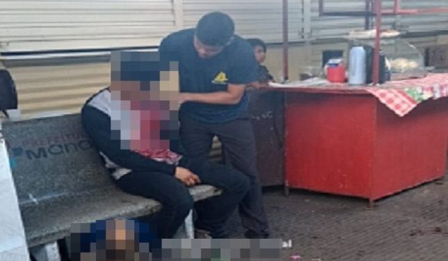 Perigo no terminal: Jovem de 18 anos é vítima de arrastão no T5 e leva facada no pescoço