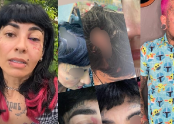 Cabeleireira conhecida em Manaus denuncia marido lutador por agressão: ‘Tomei coragem’