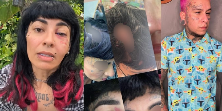 Cabeleireira conhecida em Manaus denuncia marido lutador por agressão: ‘Tomei coragem’