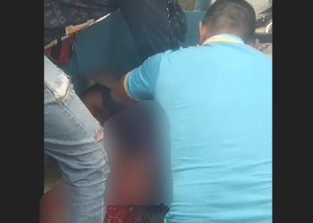 Vídeo: Em grave acidente na Cidade Nova, motoqueiro tem a perna esmagada