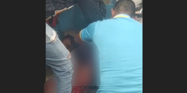 Vídeo: Em grave acidente na Cidade Nova, motoqueiro tem a perna esmagada
