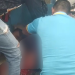 Vídeo: Em grave acidente na Cidade Nova, motoqueiro tem a perna esmagada