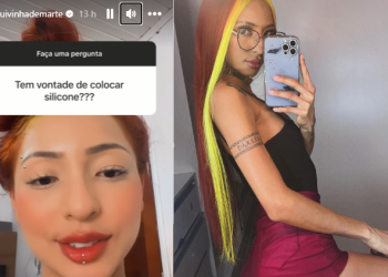 Ruivinha de Marte diz que medo de morrer a impede de colocar silicone: ‘Fico no bojo, papel, meia’