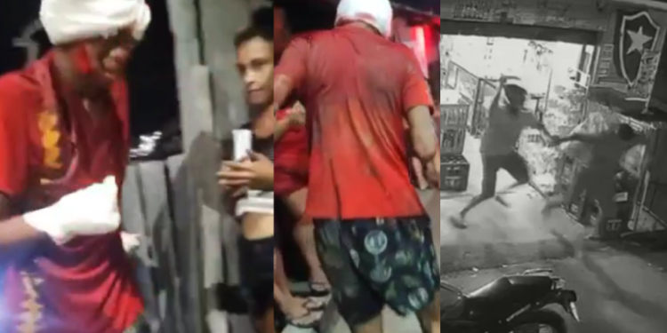 Momento em que assaltante tem mão decepada no Mauazinho foi registrado por câmeras; veja