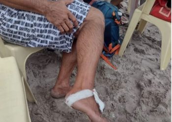 Piranhas atacam banhistas, que ficam feridos em Manaus