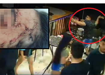 Em Manaus, casa de show Open Bar é condenada a pagar R$ 35 mil a cliente que levou garrafada na cara