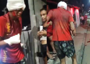 ‘Vem roubar com a outra mão agora’, diz morador a suposto ladrão que levou terçadadas em Manaus; vídeo