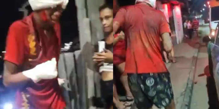 ‘Vem roubar com a outra mão agora’, diz morador a suposto ladrão que levou terçadadas em Manaus; vídeo