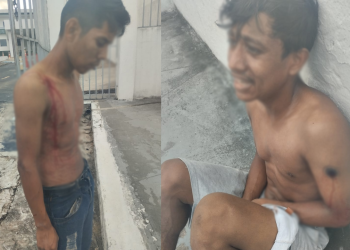 Após serem baleados por pistoleiros, irmãos pedem socorro no HMAM