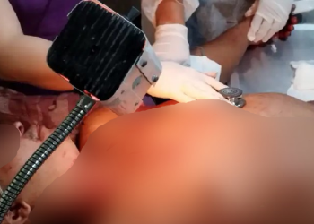 Com medo de levar chifre, homem dá 50 facadas no amigo de bar durante bebedeira no interior do AM