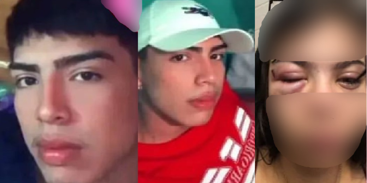 Cansada de ver a filha sofrer, sogra expõe genro agressor após mais uma surra na Zona Leste de Manaus