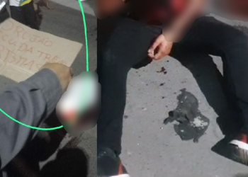 Vídeo: Baleado no pescoço no Novo Israel é encontrado com bilhete e pedindo ajuda