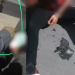 Vídeo: Baleado no pescoço no Novo Israel é encontrado com bilhete e pedindo ajuda