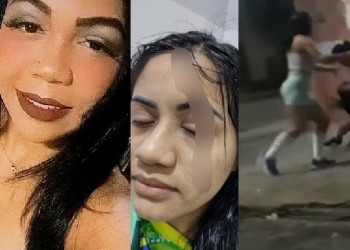 Vídeo mostra mulher sendo furada com bisturi na cara por suposta ex-amante do marido; veja