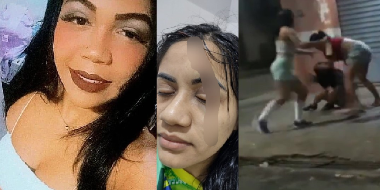 Vídeo mostra mulher sendo furada com bisturi na cara por suposta ex-amante do marido; veja