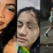 Vídeo mostra mulher sendo furada com bisturi na cara por suposta ex-amante do marido; veja