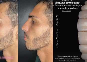 Um novo homem: Agenor Tupinambá faz harmonização facial e inicia tratamento dentário