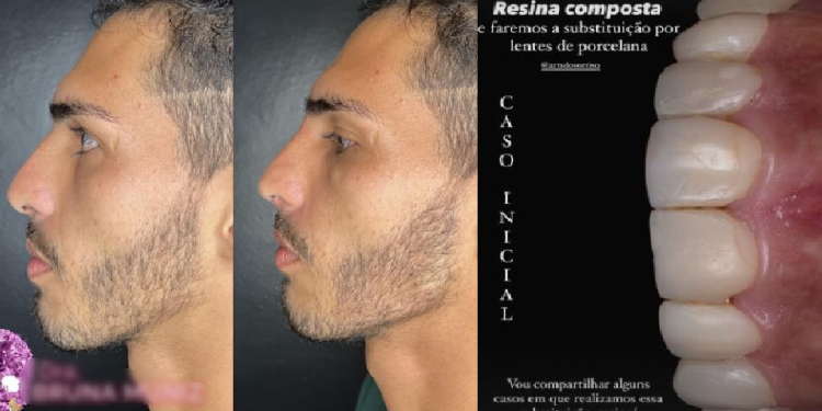 Um novo homem: Agenor Tupinambá faz harmonização facial e inicia tratamento dentário