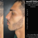 Um novo homem: Agenor Tupinambá faz harmonização facial e inicia tratamento dentário