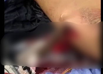 Terçadada rola solta em Tefé e homem tem a cabeça e as mãos partidas; cenas fortes