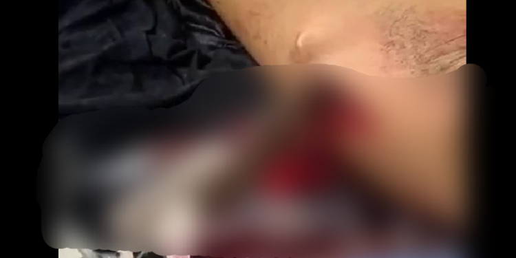 Terçadada rola solta em Tefé e homem tem a cabeça e as mãos partidas; cenas fortes