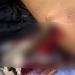 Terçadada rola solta em Tefé e homem tem a cabeça e as mãos partidas; cenas fortes