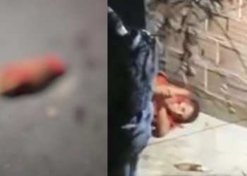 Vídeo: Homem tem a mão e orelha decepados após ser atacado em mercadinho em Manaus