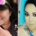 Jovem de 23 anos morre após extração do siso e vítima de infecção