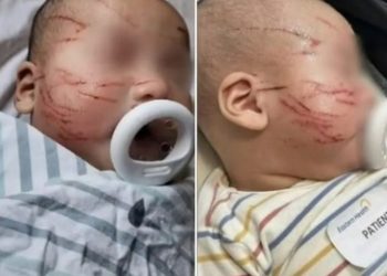 Criança vai para creche e volta com o rosto todo arranhado