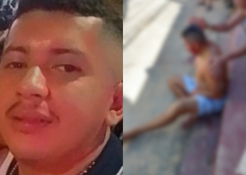 Homem baleado na cabeça agoniza no Zumbi