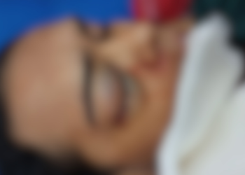 Mulher é atingida no olho após passar por trás de barraca de tiro no Via Norte