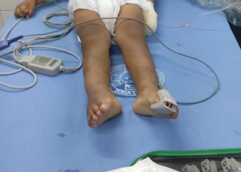 Pai é preso após espancar menino de 3 anos