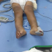 Pai é preso após espancar menino de 3 anos