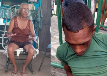 Criança vai para creche e volta com o rosto todo arranhado