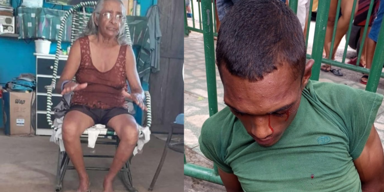 Criança vai para creche e volta com o rosto todo arranhado