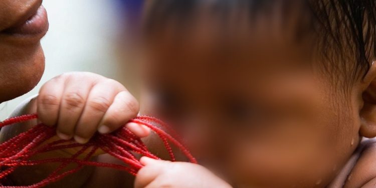 MPAM obtém busca e apreensão de recém-nascido indígena com lábio leporino e fenda palatina