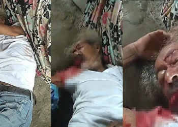 Filha surta a arranca língua de idoso de 90 anos