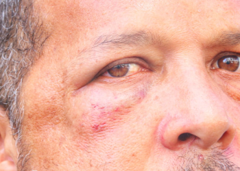 De cueca, morador de prédio de luxo é acusado de agredir entregador de APP em Manaus