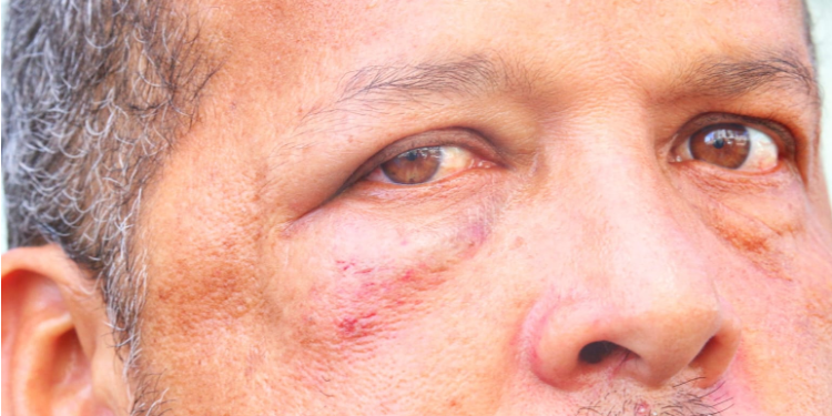 De cueca, morador de prédio de luxo é acusado de agredir entregador de APP em Manaus