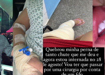 ‘Ama bater’, denuncia mulher que teve a perna quebrada por suposto dono de lavajato em Manaus