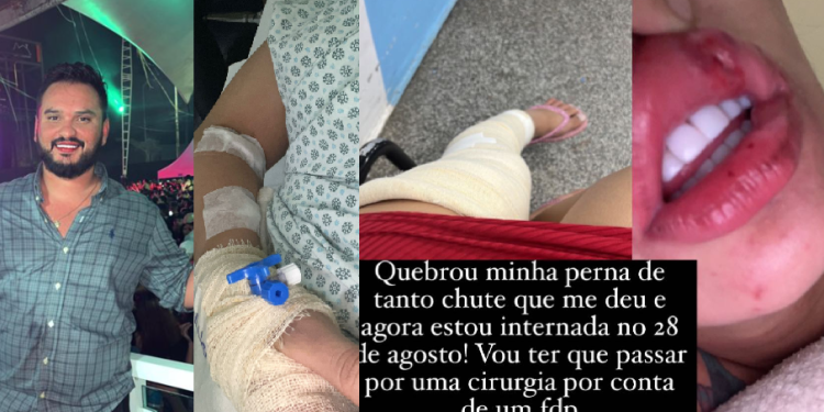 ‘Ama bater’, denuncia mulher que teve a perna quebrada por suposto dono de lavajato em Manaus