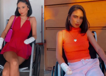 Por causa de infecção urinária, jovem tem complicações e as mãos e pernas amputadas